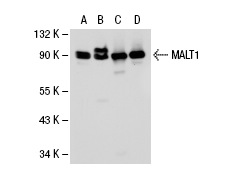  MALT1 (k100): sc-130494. Western blot analysis of MALT1 expression in Jurkat (A), Daudi (B), HeLa (C) and U68MG (D) whole cell lysates.