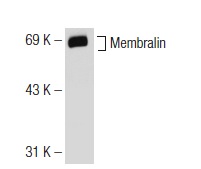  Membralin (L-19): sc-50093. Western blot analysis of Membralin expression in Jurkat whole cell lysate.