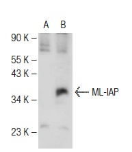  ML-IAP (4H196): sc-71592. Western blot analysis of ML-IAP expression in non-transfected: sc-117752 (A) and human ML-IAP transfected: sc-159337 (B) 293T whole cell lysates.