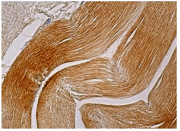  MSH3 (C-8): sc-271079. Immunoperoxidase staining of formalin fixed, paraffin-embedded human skeletal muscle tissue showing cytoplasmic staining of myocytes.