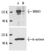  MSH3 siRNA (h): sc-35971. Western blot analysis of MSH3 expression in non-transfected control (A) and MSH3 siRNA transfected (B) HeLa cells. Blot probed with MSH3 (H-300): sc-11441. α-actinin (H-2): sc-17829 used as specificity and loading control.