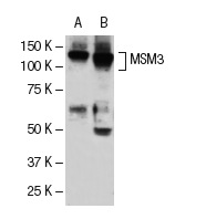  MSH3 (H-300): sc-11441. Western blot analysis of MSH3 expression in MOLT-4 (A) and HeLa (B) whole cell lysates.