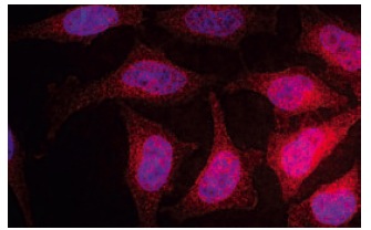  MTSS1 (M7-P3A7): sc-101390. Immunofluorescence staining of methanol-fixed HeLa cells showing cytoplasmic staining.