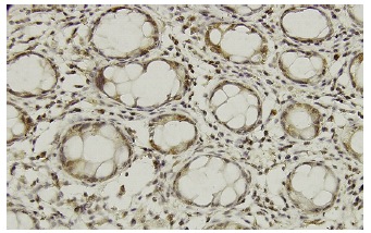  MTSS1 (SS-3): sc-101204. Immunoperoxidase staining of formalin-fixed, paraffin-embedded human colon tissue showing nuclear and cytoplasmic localization.