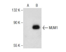  MUM1 (C-13): sc-139009. Western blot analysis of MUM1 expression in non-transfected: sc-117752 (A) and mouse MUM1 transfected: sc-121866 (B) 293T whole cell lysates.