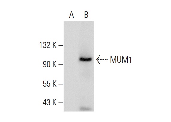  MUM1 (N-18): sc-139011. Western blot analysis of MUM1 expression in non-transfected: sc-117752 (A) and human MUM1 transfected: sc-373031 (B) 293T whole cell lysates.