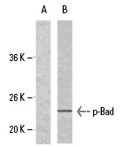  p-Bad (Ser 112): sc-101640. Western blot analysis of phosphorylated Bad expression in untreated (A) and forskolin-treated (B) 293 whole cell lysates. 