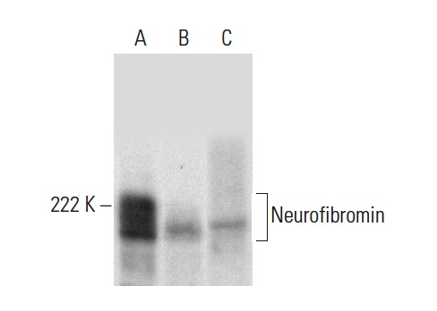  Neurofibromin (E-8): sc-398267. Western blot analysis of Neurofibromin expression in HeLa (A) and Hep G2 (B) whole cell lysates and rat brain tissue extract (C).