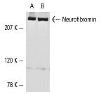  Neurofibromin (D): sc-67. Western blot analysis of Neurofibromin expression in A-431 (A) and HeLa (B) whole cell lysates.