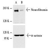  Neurofibromin siRNA (h): sc-36036. Western blot analysis of Neurofibromin expression in non-transfected control (A) and Neurofibromin siRNA transfected (B) HeLa cells. Blot probed with Neurofibromin (D): sc-67. α-actinin (H-2): sc-17829 used as specificity and loading control.