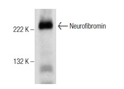  Neurofibromin (H-12): sc-376886. Western blot analysis of Neurofibromin expression in LNCaP whole cell lysate.