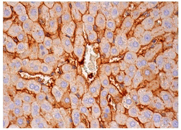  Neurofibromin (H-12): sc-376886. Immunoperoxidase staining of formalin fixed, paraffin-embedded human liver tissue showing membrane staining of hepatocytes and sinusoids.