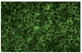  Neurofibromin (1-300): sc-20982. Immunofluorescence staining of normal mouse lymph node frozen section showing cytoplasmic staining.