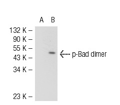  p-Bad (Ser 112): sc-101640. Western blot analysis of Bad phosphorylation in non-transfected: sc-117752 (A) and human Bad transfected: sc-170552 (B) 293T whole cell lysates.