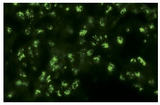  Neurofibromin (H-300): sc-20683. Immunofluorescence staining of normal mouse kidney frozen section showing cytoskeletal staining.