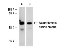  Western blot analysis of human recombinant Neurofibromin fusion protein (A,B). Antibodies tested include: Neurofibromin (H-300): sc-20683 (A) and Neurofibromin (N): sc-68 (B).