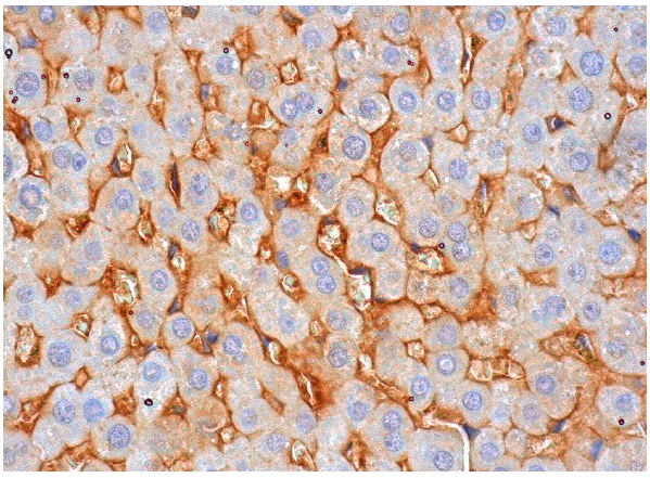  Neurofibromin (McNFn27a): sc-20017. Immunoperox-idase staining of formalin fixed, paraffin-embedded human liver tissue showing cytoplasmic staining of hepatic sinusoids.