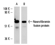  Western blot analysis of human recombinant Neurofibromin fusion protein (A,B). Antibodies tested include: Neurofibromin (H-300): sc-20683 (A) and Neurofibromin (N): sc-68 (B).