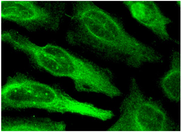  Neurofibromin (N): sc-68. Immunofluorescence stain-ing of methanol-fixed HeLa cells showing cytoplasmic localization.