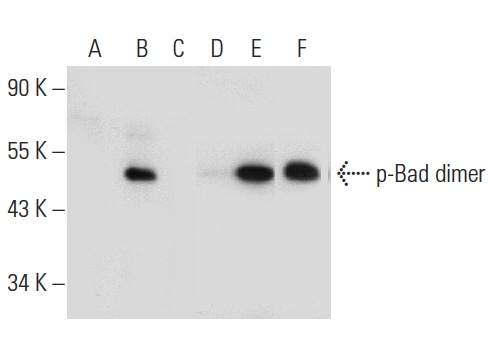  Western blot analysis of Bad phosphorylation in non-transfected: sc-117752 (A,D), untreated human Bad transfected: sc-170552 (B,E) and lambda protein phosphatase (sc-200312A) treated human Bad transfected: sc-170552 (C,F) 293T whole cell lysates. Antibodies tested include p-Bad (Ser 112): sc-101640 (A,B,C) and Bad (H-168): sc-7869 (D,E,F).