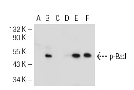  Western blot analysis of Bad phosphorylation in non-transfected: sc-117752 (A, D), untreated human Bad transfected: sc-170552 (B, E) and lambda protein phosphatase treated human Bad transfected: sc-170552 (C, F) 293T whole cell lysates. Antibodies tested include p-Bad (Ser 112): sc-101640 (A, B, C) and Bad (H-168): sc-7869 (D, E, F).