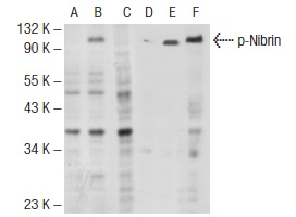  Western blot analysis of Nibrin phosphorylation in untreated (A, D), UV irradiated (B, E) and UV irradiated and lambda protein phosphatase treated (C, F) HeLa whole cell lysates. Antibodies tested include p-Nibrin (Ser 343)-R: sc-12936-R (A, B, C) and Nibrin (1D7): sc-56166 (D, E, F).