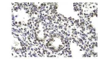  NKD1 (A-21): sc-102039. Immunoperoxidase staining of formalin fixed, paraffin-embedded human lung tissue showing nuclear and cytoplasmic staining.