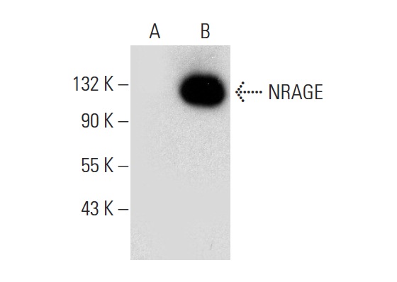  NRAGE (H-7): sc-398493. Western blot analysis of NRAGE expression in non-transfected: sc-117752 (A) and mouse NRAGE transfected: sc-122121 (B) 293T whole cell lysates.