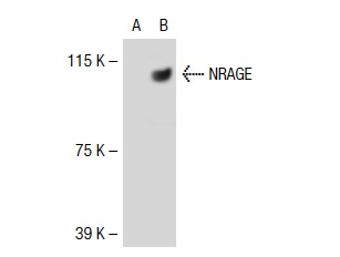  NRAGE (H-300): sc-28243. Western blot analysis of NRAGE expression in non-transfected: sc-117752 (A) and human NRAGE transfected: sc-114826 (B) 293T whole cell lysates.