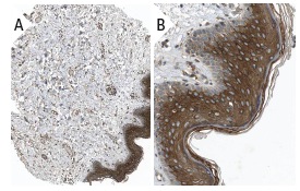  NRAGE (H-300): sc-28243. Immunoperoxidase staining of formalin fixed, paraffin-embedded human skin tissue showing cytoplasmic staining of adnexal and epidermal cells at low (A) and high (B) magnification. Kindly provided by The Swedish Human Protein Atlas (HPA) program.