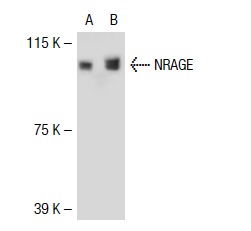  NRAGE (T-20): sc-14398. Western blot analysis of NRAGE expression in non-transfected: sc-117752 (A) and human NRAGE transfected: sc-114826 (B) 293T whole cell lysates.