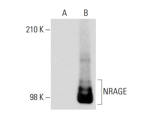  NRAGE (T-20): sc-14398. Western blot analysis of NRAGE expression in non-transfected: sc-117752 (A) and mouse NRAGE transfected: sc-122121 (B) 293T whole cell lysates.