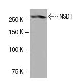  NSD1 (K47): sc-130470. Western blot analysis of NSD1 expression in human uterus tissue extract.