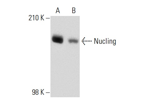  Nucling (N-13): sc-135511. Western blot analysis of Nucling expression in HeLa (A) and MIA PaCa-2 (B) whole cell lysates.