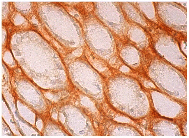  Nucling (N-13): sc-135511. Immunoperoxidase staining of formalin fixed, paraffin-embedded human kidney tissue showing basolateral membrane staining of cells in tubules.