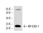  NY-ESO-1 (E978): sc-53869. Western blot analysis of NY-ESO-1 expression in U266 nuclear extract.