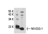  NY-ESO-1 (6A146): sc-71734. Western blot analysis of NY-ESO-1 expression in U266 nuclear extract.