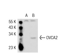  OVCA2 (P-18): sc-54645. Western blot analysis of OVCA2 expression in non-transfected: sc-117752 (A) and human OVCA2 transfected: sc-115821 (B) 293T whole cell lysates.