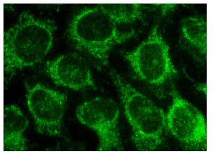  OVCA2 (P-18): sc-54645. Immunofluorescence staining of methanol-fixed HeLa cells showing cytoplasmic localization.