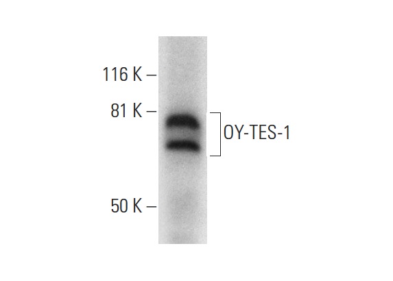  OY-TES-1 (G-5): sc-390594. Western blot analysis of OY-TES-1 expression in human testis tissue extract.