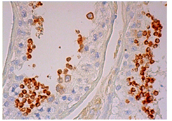  OY-TES-1 (G-5): sc-390594. Immunoperoxidase staining of formalin fixed, paraffin-embedded human testis tissue showing cytoplasmic staining of a subset of cells in seminiferous ducts.