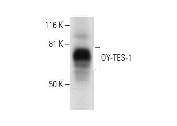  OY-TES-1 (H-158): sc-292428. Western blot analysis of OY-TES-1 expression in human testis tissue extract.