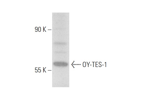  OY-TES-1 (H-158): sc-292428. Western blot analysis of OY-TES-1 expression in Hep G2 whole cell lysate.