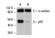  p53 siRNA (h): sc-29435. Western blot analysis of p53 expression in control non-transfected (A) and p53 siRNA transfected (B) HeLa cells. Blot probed with p53 (D0-1): sc-126. α-actinin (H-2): sc-17829 used as specificity and loading control.