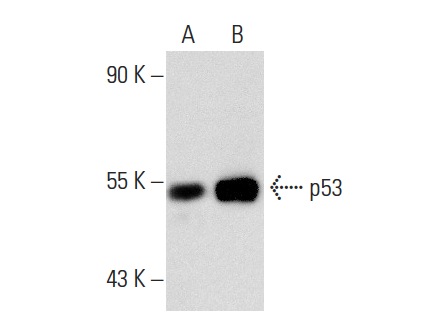  p53 (DO-1): sc-126. Western blot analysis of p53 expression in untreated (A) and Tenovin-1 (sc-222342) treated (B) MCF7 whole cell lysates. Note upregulation of p53 expression in lane B.