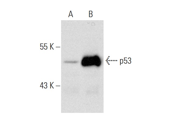  p53 (DO-1): sc-126. Western blot analysis of p53 expression in untreated (A) and Actinomycin D (sc-200906) treated (B) MOLT-4 whole cell lysates.