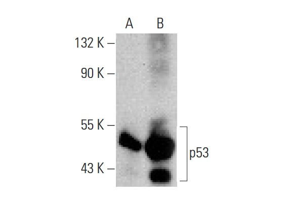  p53 (DO-1): sc-126. Western blot analysis of p53 expression in untreated (A) and SN 38 (sc-203697) treated (B) HCT 116 whole cell lysates. Note upregulation of p53 expression in lane B.