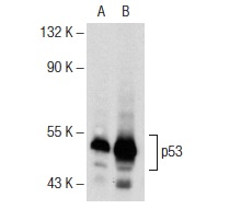  p53 (DO-1): sc-126. Western blot analysis of p53 expression in untreated (A) and RITA (sc-202753) treated (B) HCT 116 whole cell lysates. Note upregulation of p53 expression in lane B.