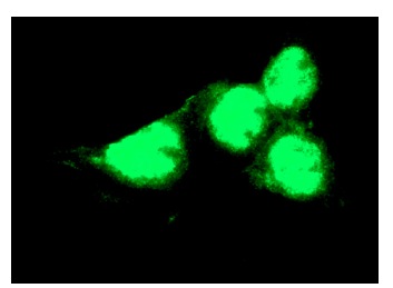  p53 (FL-393): sc-6243. Immunofluorescence staining of methanol-fixed A-431 cells showing nuclear localization.