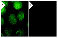  p53 siRNA (h): sc-29435. Immunofluorescence staining of methanol-fixed, control HeLa (A) and p53 siRNA silenced HeLa (B) cells showing diminished nuclear staining in the siRNA silenced cells. Cells probed with p53 (FL-393): sc-6243. 